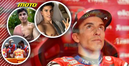 Χειρουργείο για Marc Marquez! Απέτυχε η συντηρητική προσέγγιση – Τοποθέτησαν δύο βίδες