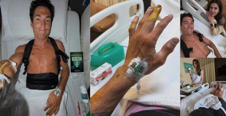 MotoGP Honda: Σοβαρό ατύχημα σε δοκιμές στην Sepang για Aleix Espargaro!