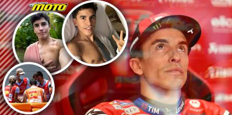 Χειρουργείο για Marc Marquez! Απέτυχε η συντηρητική προσέγγιση – Τοποθέτησαν δύο βίδες