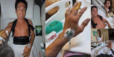 MotoGP Honda: Σοβαρό ατύχημα σε δοκιμές στην Sepang για Aleix Espargaro!