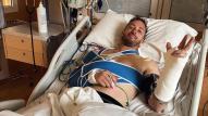 Andrea Dovizioso – Στο νοσοκομείο μετά από πτώση σε ιδιωτική πίστα MX